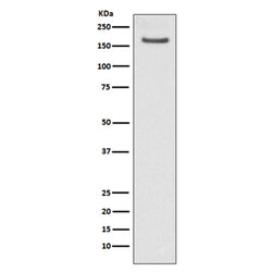 FANCD2 rabbit monoclonal antibody