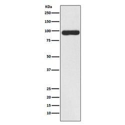 FAP rabbit monoclonal antibody