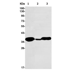 FBL rabbit monoclonal antibody