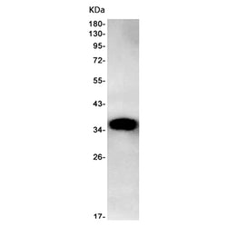 FBP1 rabbit monoclonal antibody