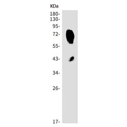 FCGR1A rabbit monoclonal antibody