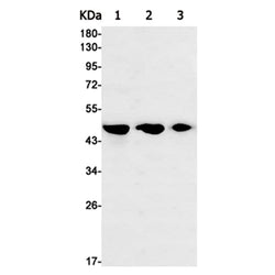 FDFT1 rabbit monoclonal antibody