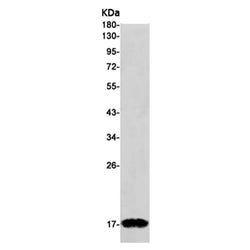 FDX1 rabbit monoclonal antibody