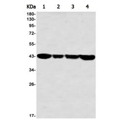 FEN1 rabbit monoclonal antibody