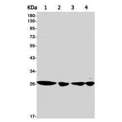 FGF7 rabbit monoclonal antibody