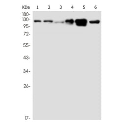 FGFR3 rabbit monoclonal antibody