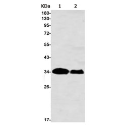 FHL1 rabbit monoclonal antibody