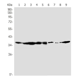 FKBP6 rabbit monoclonal antibody