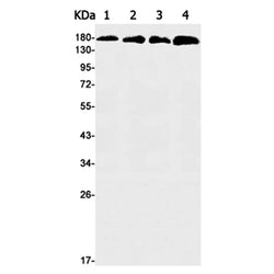 FLT1 rabbit monoclonal antibody