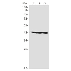 FNTA rabbit monoclonal antibody