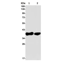 FOSL2 rabbit monoclonal antibody