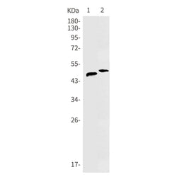 FOXA1 rabbit monoclonal antibody