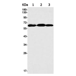 FOXO4 rabbit monoclonal antibody