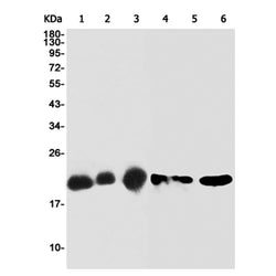 FTH1 rabbit monoclonal antibody
