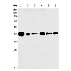 GALT rabbit monoclonal antibody