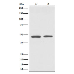 GATA3 rabbit monoclonal antibody