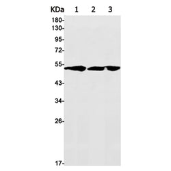 GC rabbit monoclonal antibody
