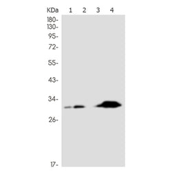 GCLM rabbit monoclonal antibody