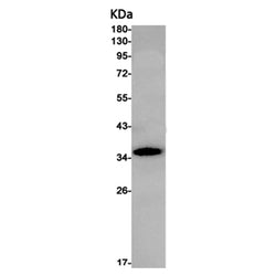 GDF15 rabbit monoclonal antibody