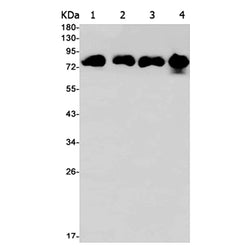 GLB1 rabbit monoclonal antibody