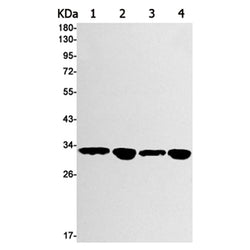 GNB2 rabbit monoclonal antibody