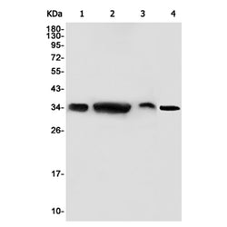GNB3 rabbit monoclonal antibody