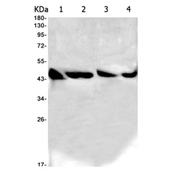 GOT1 rabbit monoclonal antibody