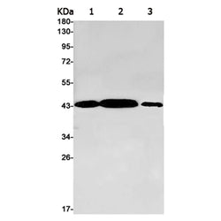 GOT2 rabbit monoclonal antibody