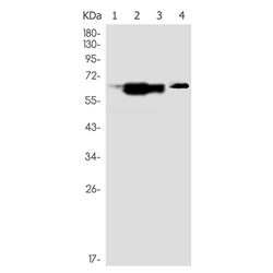GRK6 rabbit monoclonal antibody