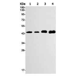 GSK3B rabbit monoclonal antibody