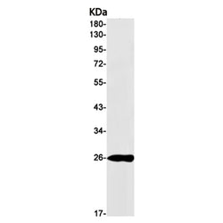 GSTK1 rabbit monoclonal antibody
