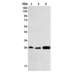 GSTM1 rabbit monoclonal antibody