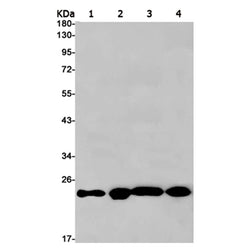 GSTP1 rabbit monoclonal antibody