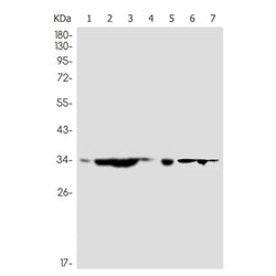 GTF2B rabbit monoclonal antibody