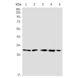 Histone H1.2 rabbit monoclonal antibody