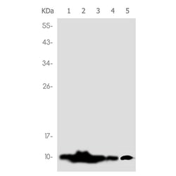 Histone H4 (acetyl-Lys5)  rabbit monoclonal antibody
