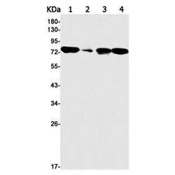 HADHA rabbit monoclonal antibody