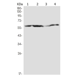 HCK rabbit monoclonal antibody