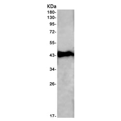 HDAC8 rabbit monoclonal antibody