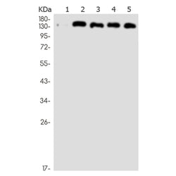 HDLBP rabbit monoclonal antibody