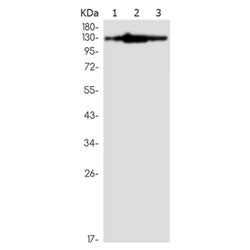 HIPK2 rabbit monoclonal antibody