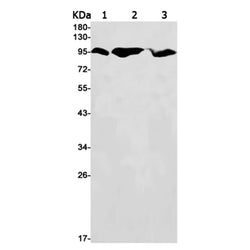 HK1 rabbit monoclonal antibody