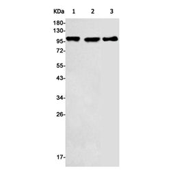 HK2 rabbit monoclonal antibody