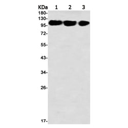 HKDC1 rabbit monoclonal antibody