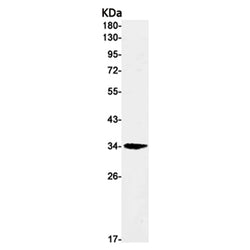 HMGCL rabbit monoclonal antibody