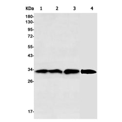 HMOX1 rabbit monoclonal antibody