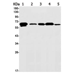HNRNPK rabbit monoclonal antibody