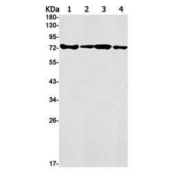 HNRNPM rabbit monoclonal antibody