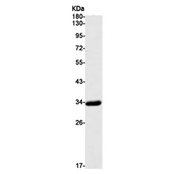 HOXB4 rabbit monoclonal antibody