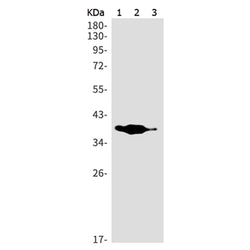 HPDL rabbit monoclonal antibody